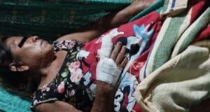 Perros pitbull atacan a abuelita en Hecelchakán: podría perder un dedo