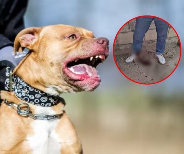 abuelito atacado por pitbull abuelito atacado por pitbull
