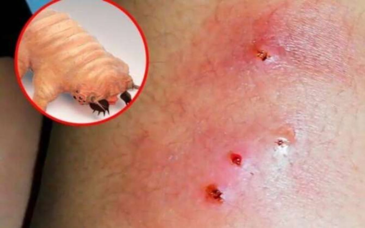 Cuáles son los síntomas de infestación por gusano barrenador en humanos: Un  riesgo que alarma en Yucatán