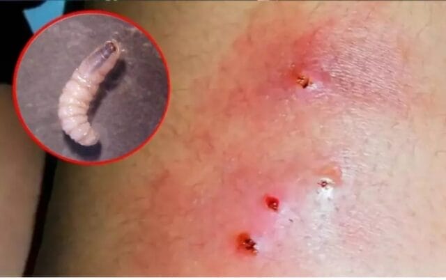 Campeche casos miasis gusano barrenador personas