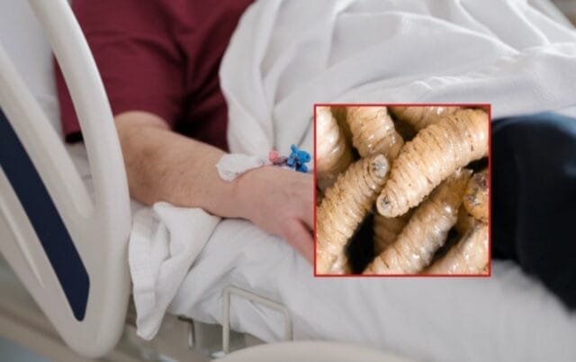 gusano barrenador personas con gusano devorador de hombres segundo Carmen Campeche