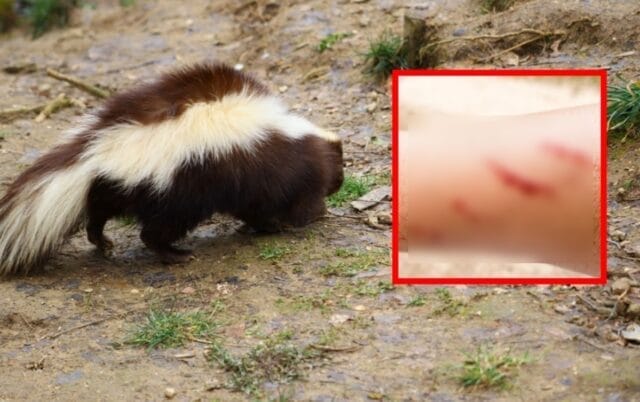 salvar menor mordida zorrillo con rabia