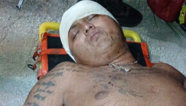 Batalla campal en Temax deja cuatro lesionados con machete y bate