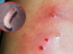 Gusano barrenador se expande en Yucatán; hay 10 casos de personas afectadas en el Estado