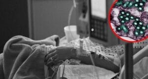 Paciente muere por rabia tras recibir un trasplante de riñón