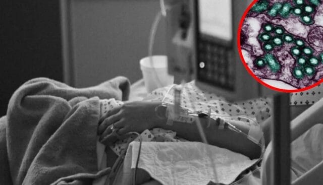 Paciente muere por rabia tras recibir un trasplante de riñón