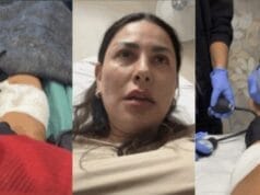 Pitbull sin vacunas ataca a Gaby Ramírez; actriz teme perder una extremidad