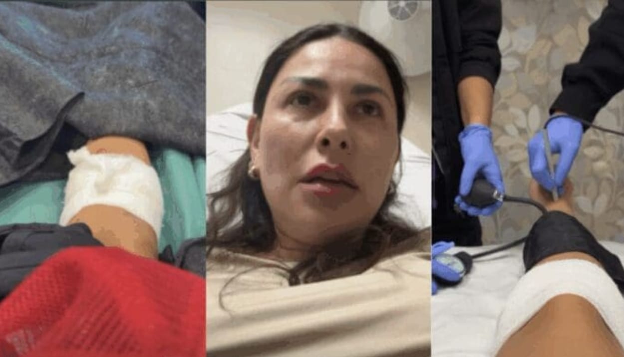 Pitbull sin vacunas ataca a Gaby Ramírez; actriz teme perder una extremidad  - La i Noticias