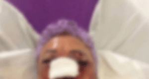 Del casino al hospital: mujer es atacada para robarle dinero en Mérida