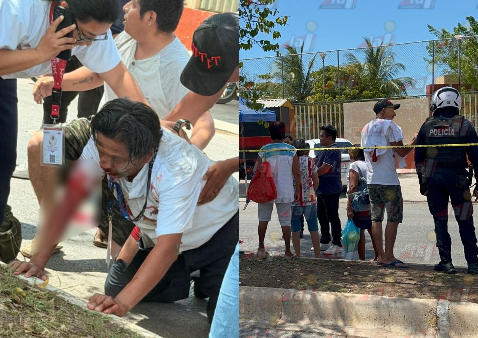 Chofer atropellado en Campeche recibe alta voluntaria y continúa ...